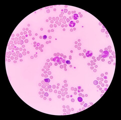 Light microscopic picture show erythrocyte, giant platelet, neutrophil, lymphocyte, nucleated red...