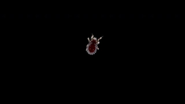 Acari (mite) Oribatida Family Carabodidae under microscope. The genus Carabodes sp. Sample found in Karelia
