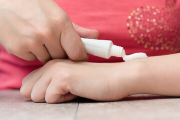 Woman is applying a pain reliever cream to her hand close up.
