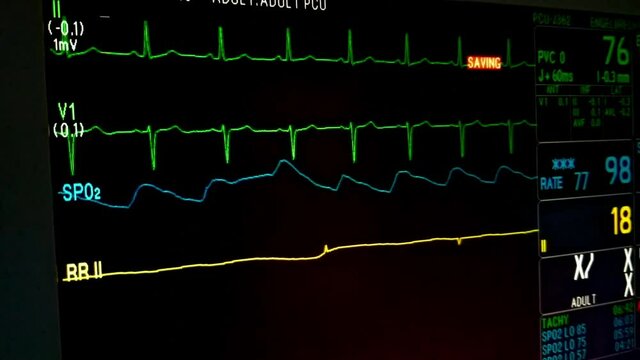 EKG, Pulse, Oxygen and Respiration ICU Monitor Screen