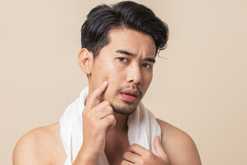  Portrait Young adult Asian man worry have blemish on face caused by acne. Facial face care,...