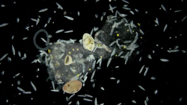 Colony infusorium Ciliophora of the genus Paramecium under a microscope, order Peniculida. Cilia help to move, feeds on bacteria and other small organisms. Planktonic organism