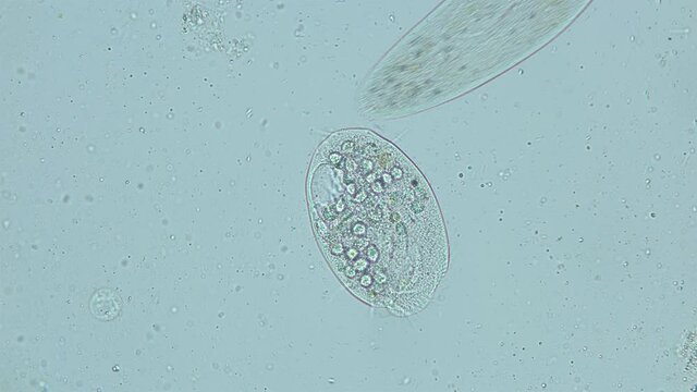 infusorium Ciliophora Subclass Hypotrichia under a microscope, Class Spirotrichea. . Planktonic organism