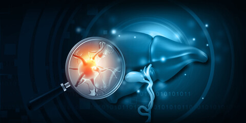 Hepatitis b infected liver. 3d illustration