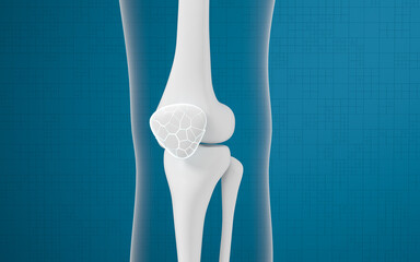 Leg bones and knees, 3d rendering.