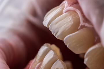 Teeth macro