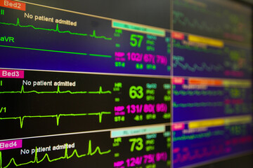 Modern vital sign monitor on patient background at ward in the hospital. - obrazy, fototapety, plakaty