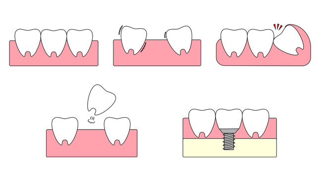 グラグラ の画像 55 件の Stock 写真 ベクターおよびビデオ Adobe Stock