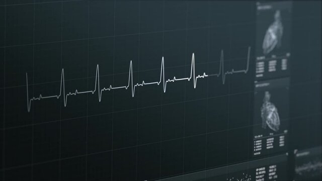 Dynamic heart rate or heart beat line. Cardiogram signal monitoring process. Patient&rsquo;s vital signs displayed on hospital screen. Dynamic EKG, ECG curve. Pulse measuring. Medical 4K footage. Cardiology