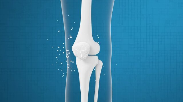 Leg bone and knee healing, 3d rendering.