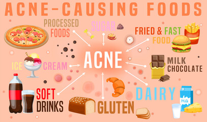 What causes acne. Acne-causing food. Horizontal poster