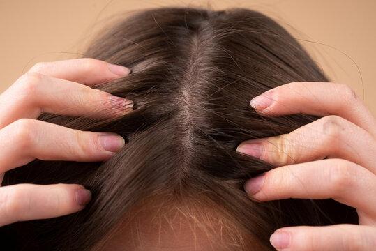 Concept of hair loss. Hair loss close up. tangled Problem hair.