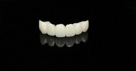 Long dental zirconia bridge with all porcelain baked