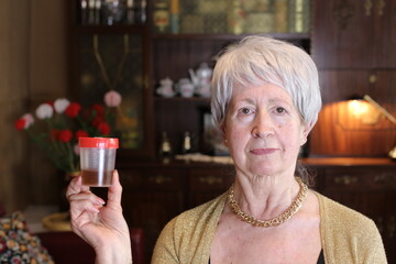 Lady holding sample for urine checkup