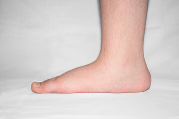 Close up of mans bare foot with strong flat feet also called pes planus or fallen arches. - obrazy, fototapety, plakaty