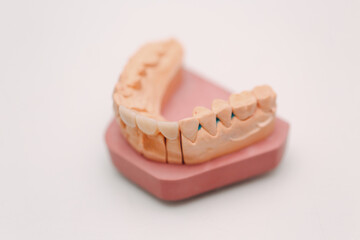 Dental layout of the human jaw with teeth and implants