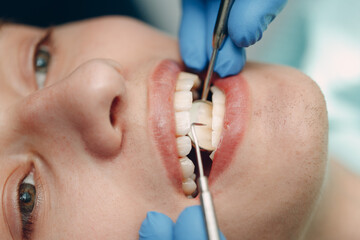 Dentistry. Dentist and patient. Dental clinic. Close up teeth.