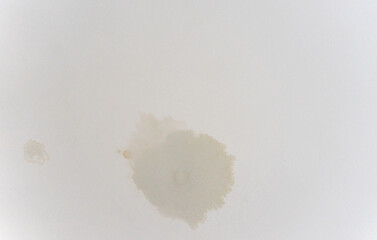 Stains on the ceiling after flooding by neighbors, repair, restoration after the flood