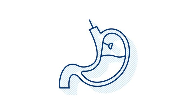 Stomach endoscopy. Endoscope in stomach through esophagus. Motion graphics.