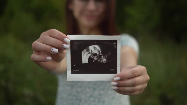 A young pregnant woman holds an ultrasound picture of a baby in her hands. Girl in nature.
