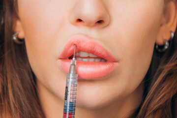 Lip augmentation. Beautiful woman's mouth receives hyaluronic acid injection. Close-up. Beauty...