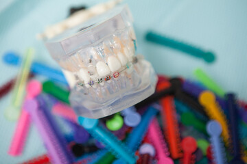 Dentures model with braces on pile of colorful elastics