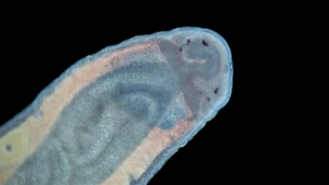 Worm Nemertea Prostoma sp. under the microscope, of the Tetrastemmatidae family. Freshwater species, predator. Close-up of head