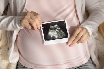 Expectant mother holding ultrasound scan at big tummy, showing picture at camera. Cropped shot of...