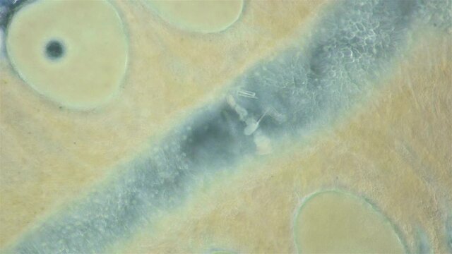 Worm Nemertea Prostoma sp. under microscope, of Tetrastemmatidae family. Freshwater species, predator. Internal organs are visible: stylet and gonads, part of intestine
