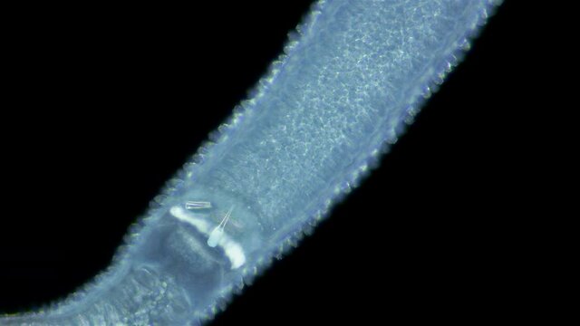 Worm Nemertea Prostoma sp. under the microscope, of the Tetrastemmatidae family. Freshwater species, predator. You can see how the stiletto moves in the proboscis