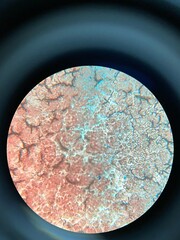 closeup photo of blood smear under microscope