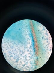 closeup photo of blood smear under microscope