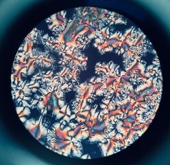 ascorbic acid crystals under microscope