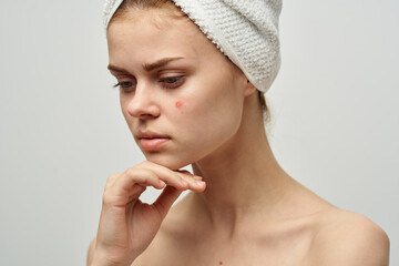 woman bare shoulders dermatology isolated background