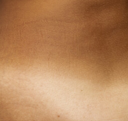 contrast of tanned and fair skin as background