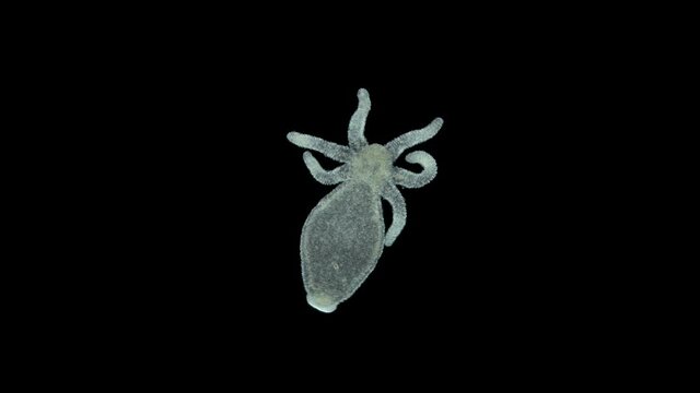 Freshwater Hydra under microscope, class Hydrozoa. Predator, feeds on small crustaceans, worms-Oligochaeta, capturing them with tentacles with stinging cells