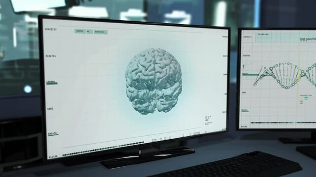 The X-ray scanner is used at the modern hospital. The X-ray is examining the structure of the patient's brain at the hospital. The X-ray has detected the brain tumor substance. Hospital Check-up. UI.