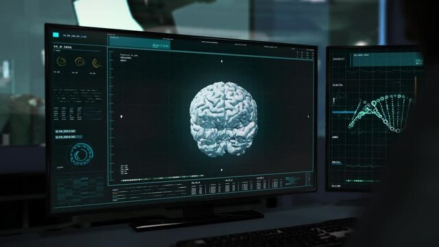 Brain Scan Analyzed In Advanced Medical Software At Neurosurgery Laboratory. Neurosurgery Research To Set Diagnosis. Detection Of Oncology Disease. Neurosurgery Examination.