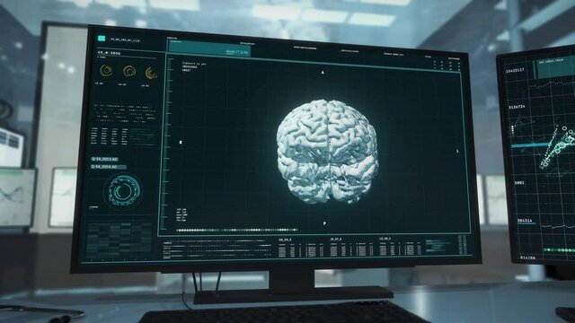 Medical oncology laboratory system. Medical oncology laboratory is checking the Patient's Brain for abnormalities. Medical oncology laboratory has found the Dangerous Tumor. Computer User Interface.