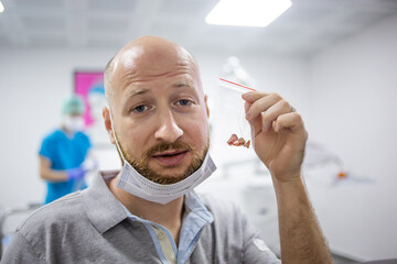 Caucasian male showing his teeth in his hand after a wisdom tooth extraction surgery in a dental hospital