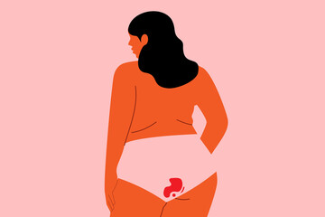 Normalizing menstruation. Concept on body positivity and period. Plus size woman in underwear with menstrual blood stain. Flat vector illustration isolated on pink background. Minimal character design - obrazy, fototapety, plakaty