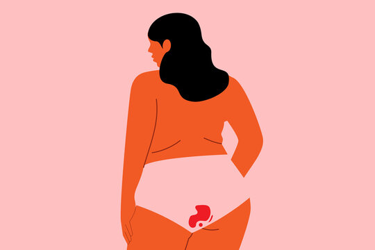 Normalizing menstruation. Concept on body positivity and period. Plus size woman in underwear with menstrual blood stain. Flat vector illustration isolated on pink background. Minimal character design