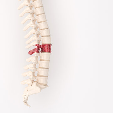 backbone with red fragmented vertebrae.