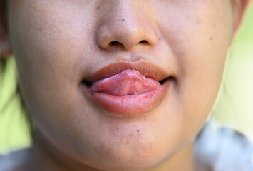 Close up of Asia woman with white teeth smiling and sticking.