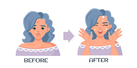 A sad woman with problem skin and a young happy girl with perfect skin. Before and after. Facial treatments, protecting the skin of the face and preserving beauty. Skin care. Vector illustration