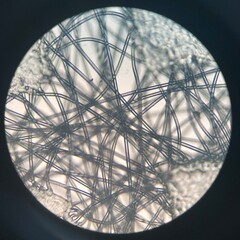 photo of medical face mask fibers under microscope
