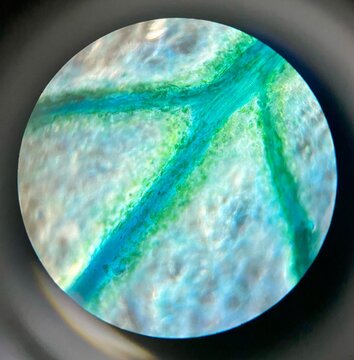 microscopic photo of the leaf of Portulaca oleracea plant