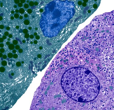 Pancreas, TEM