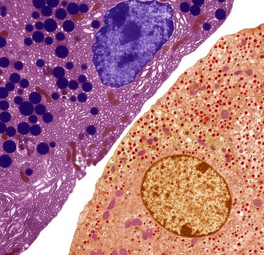 Pancreas, TEM