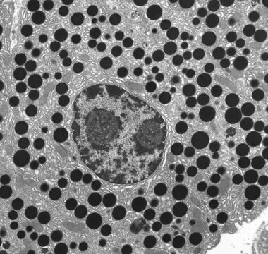 Pancreas, TEM